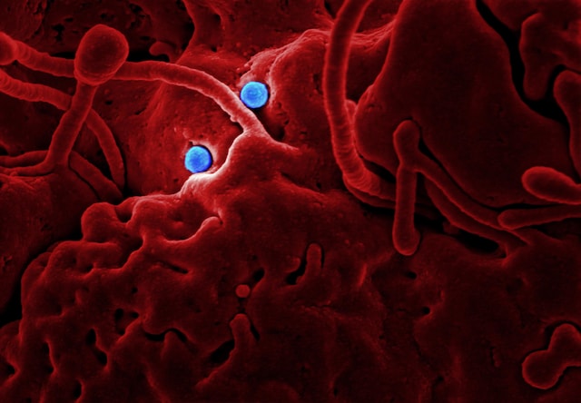 Zakażenie bakterią Enterococcus faecalis